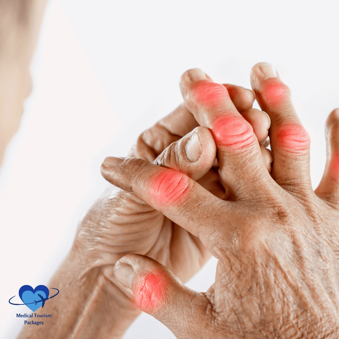 Regain mobility and improve quality of life with rheumatology surgery in Latin America
